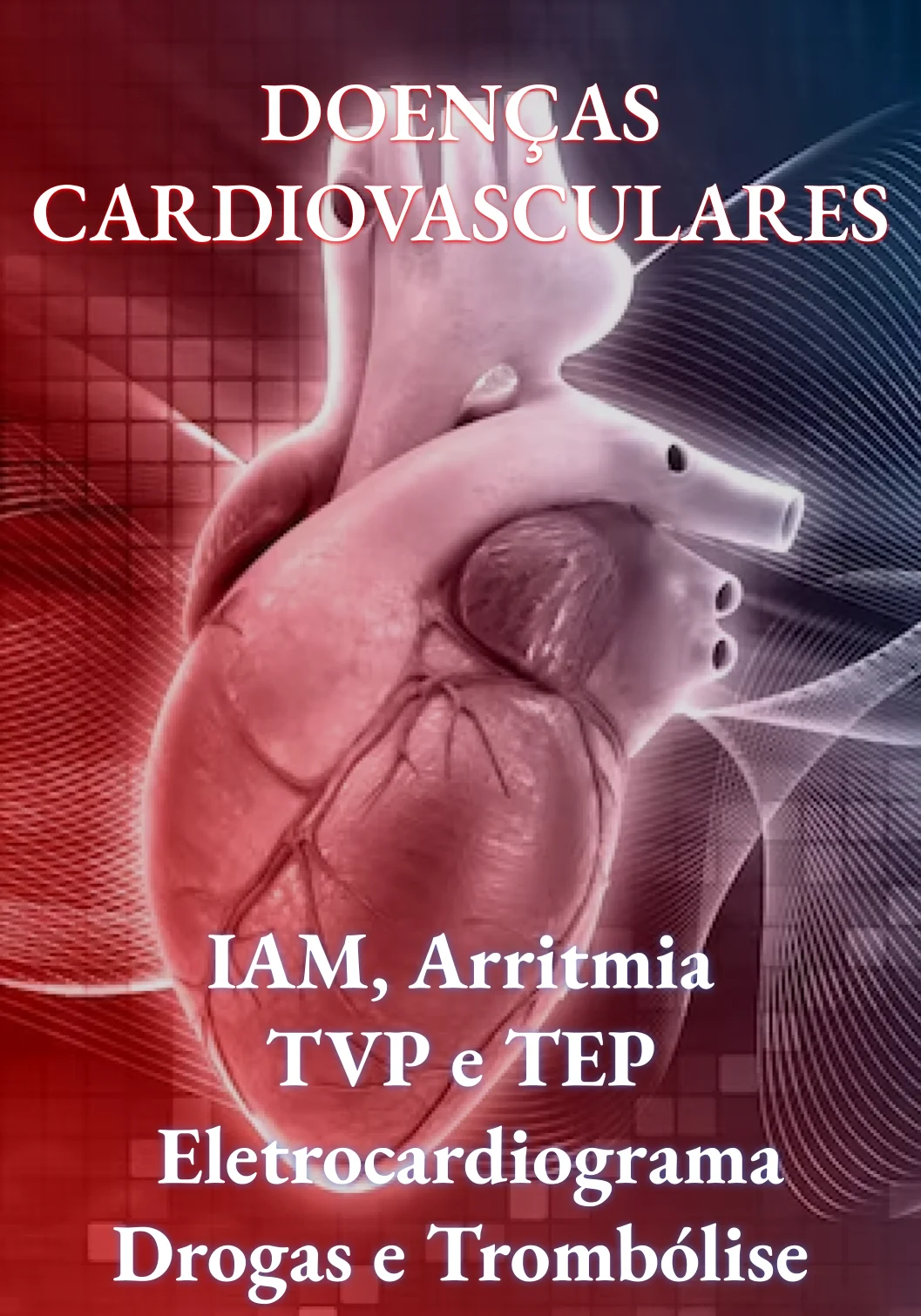 IAM, arritmias, TVP e TEP
